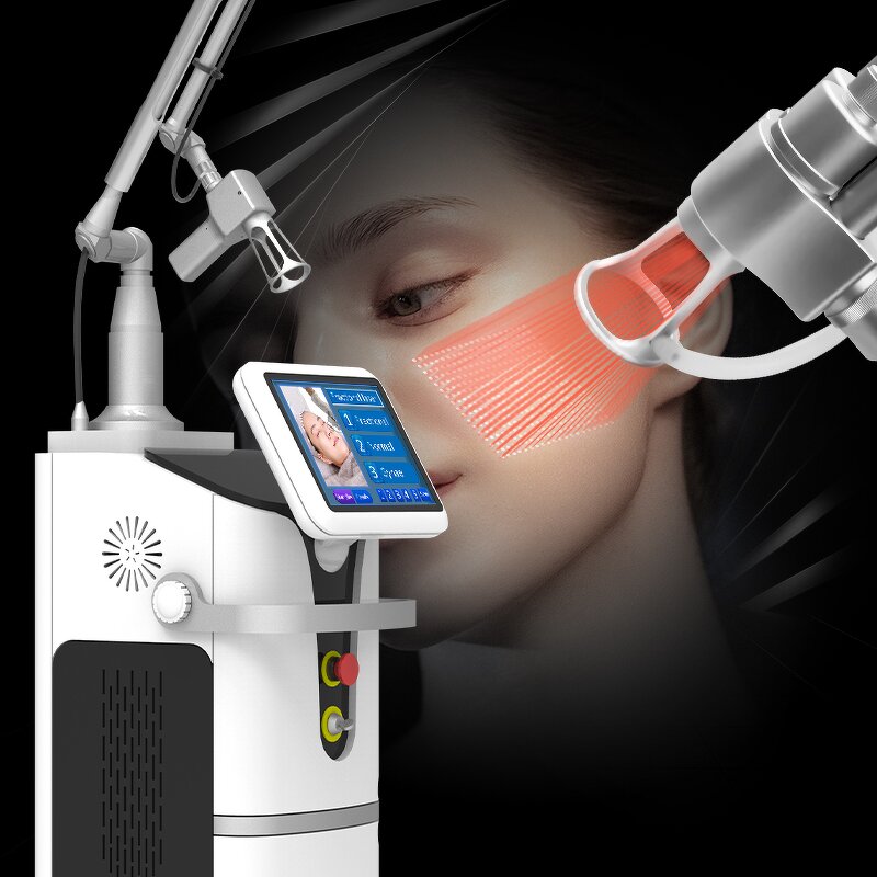 CO2 Laser Machine Manufacturer - 75W Co2 Fractional for Vaginal Tightening & Acne Scar Removal