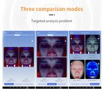 Skin Analyzer Machine Manufacturer - HD Cameras AI Technology 3D Portable