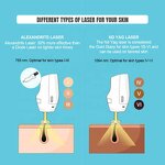 Laser Hair Removal Machine Manufacturer - 755 nm 1064 nm Long Pulse for Pussy Hair Removal