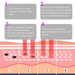 Fractional Laser Manufacturer - 1927nm Nonablative Subablative Thulium for Facial