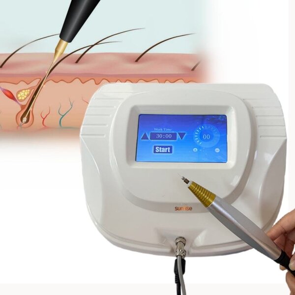 Electrolysis Hair Removal Machine Manufacturer - Non Invasive for White Skin and Hair