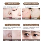 Hydrogen-Oxygen Small Bubble Beauty Device Manufacturer - For Facial Cleansing Oxygen Injection & Hydration