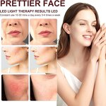 Red Light Therapy Lamp Manufacturer - 30w Standing for Body & Face Pain Relief 660nm/850nm