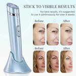 Eye Massage Tools Manufacturer - Skin Care Home Summer Massager Products for Eliminating Eye Wrinkles Beauty Device