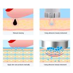 Facial Cleaning Machine Manufacturer - 9 in 1 Multi-functional Frequency for Spot Removal Blackhead Vacuum