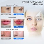 Hyaluronic Acid Pen Manufacturer - No Needle Liquid Inject Portable 0.5ml Ampoule Sterile Disposable for Face Care