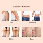 Body Care Machine Manufacturer - Professional 3-in-1 40k for Body Firming