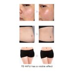 Facial Treatment Machine Manufacturer - Portable 7D for Face Lifting Skin Beauty for Salon