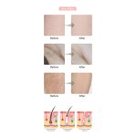 Hair Removal Machine Manufacturer - Portable OPT Painless for Skin Care IPL