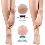 Electric Foot File Manufacturer - 2025 Professional Rechargeable Cordless Feet Callus Remover Machine