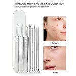 Blackhead Remover Set Manufacturer - Professional Stainless Steel Pimples Popper Comedone Extractor Tool for Nose Face Skin