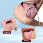 Tongue Cleaner Manufacturer - Custom Logo Stainless Steel Reduce Bad Breath Oral Care Tool with Ridges for Men Women