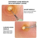 Electric Blackhead Removal Tool Manufacturer - Professional 5-in-1 Pimple Popper Face Acne Needle Comedone Extraction Kit with LED Light