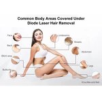 Diode Laser Hair Removal Machine Manufacturer - 755 808 1064nm Salon Use Permanent Hair Removal Device