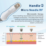 Gold RF Microneedle Hifu Machine Manufacturer - 2 in 1 7D High Intensity Focused Ultrasound Wrinkle Remover