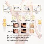 Tecartherapy Machine Manufacturer - RET CET 448K RF Body Slimming Beauty Device