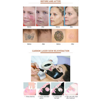 Picosecond Laser Machine Manufacturer - 532nm 755nm 1064nm 1320nm Tattoo Spots Freckle Removal Device