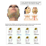 Crystallite Depth 8 Gold Rf Machine Manufacturer - Multifunction Cold Hi-fu Vmax Cold Hammer Device