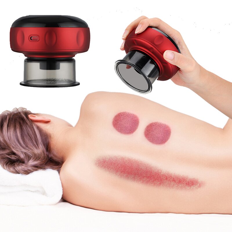 Electric Cupping Massager Manufacturer - Smart Vacuum Therapy Guasha Hijama Cups OEM Cellulite