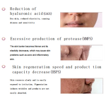 Plasma Treatment Machine - 40% Wound Reduction Bacteria Inflammatory Acne Skin Allergies Eczema LED Desktop