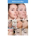 Elight IPL Machine - Hair Removal Skin Rejuvenation Whitening Acne Spot Removal Dual Handles Salon Device