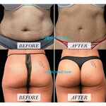 EMS Body Shaping Machine Manufacturer - Wholesale Electronic Muscle Stimulator Hand Firming Weight Loss Standing ABS