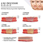 RF EMS Anti-Aging Machine - Professional Non-Invasive Radio Frequency Skin Lift Neck Eye Feet US/IT/ZA/CN