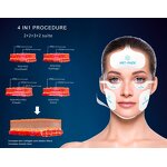 EMS Facial Machine Manufacturer - Desktop Magnetic Face Firming Anti-Aging Radio Frequency Wrinkle Remover Beauty Equipment