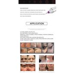 3 in 1 Fractional Plasma - New Arrival Professional ABS RF Spot Removal Skin Tightening Face Lift