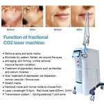 CO2 Fractional Laser Machine Manufacturer - 2025 Medical Home Use Aesthetic Acne Scar Treatment Beauty Equipment