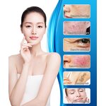 Laser Hair Removal Machine - 2000W Stationary Permanent Skin Rejuvenation Salon Beauty Equipment