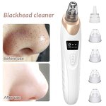 Blackhead Vacuum Cleaner Manufacturer - USB Electric Pore Cleaning Acne Removal 3-Color Light Beauty Instrument