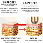 RF Beauty Equipment Manufacturer - 2024 2 in 1 V-Max Radar Line ABS UK Plug Face Eye Lifting Wrinkle Removal Spa Device