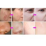 Small Bubble Facial Instrument Manufacturer - Portable 10 in 1 Oxygen Jet Facial Beauty Device