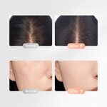 Head Massager Manufacturer - Multi-function Vibration with Facial Cleansing Brush