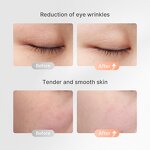 Face Roller Manufacturer - Microcurrent LED Therapy for Home Facial Care