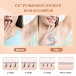 IPL Hair Removal Machine Manufacturer - Home Use with 300,000 Flashes Laser