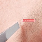 Ingrown Hair Tweezer Factory - Flat and Slant Pointed Great Precision Professional Stainless Steel