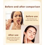 LED Facial Mask Manufacturer - Professional Red Photon 7 Color for Home Use