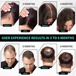 Scalp Massager Manufacturer - Rechargeable Home Use USB Electric Hair Growth Comb