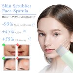 Dual-Mode Blackhead Remover Manufacturer - Handheld Skin Scrubber Face Spatula Deep Cleansing Skin Care Tool