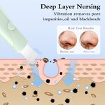 Dual-Mode Blackhead Remover Manufacturer - Handheld Skin Scrubber Face Spatula Deep Cleansing Skin Care Tool