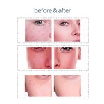 LED Photon Therapy Machine Manufacturer - 2026 Red Blue Near Infrared 7 Colors Anti Aging Facial PDT 12V/3A 32W Tool