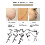 CO2 Laser Treatment Scanner Manufacturer - 40/60W 10600nm Erbium Fractional Home Scar Freckle Removal Tool