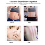 448kHz CET RET RF Machine Manufacturer - Portable 3-in-1 Facial Lifting Body Slimming Deep Heat Physiotherapy Tool