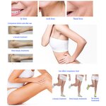 Excilift Ultra360 RF Machine Manufacturer - Factory Price Eye Bag Removal Monopolar Rf Skin Tightening Tool