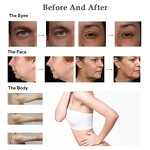 2in1 Monopolar Radio Frequency Machine Manufacturer - Professional 40.68MHz Thermal Face Lift Heat RF Tool