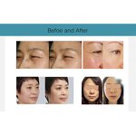 Bipolar Focused Rf Machine Manufacturer - Home Use 40.68 Mhz Thermal Skin Tightening Double Chin Slimming Tool