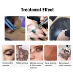 Mini Picosecond Laser Machine Manufacturer - 532/1064/1320nm Q Switched Nd Yag Portable Tattoo Removal Tool