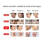 Thermal Lift Bipolar RF Machine Manufacturer - 2026 LED Anti-Aging Wrinkle Removal Face Lifting US IT Plug Tool